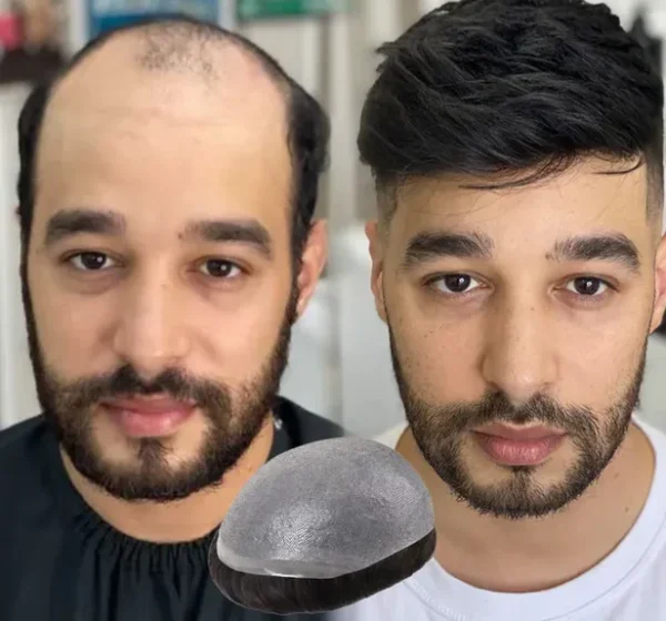 Men's Hair Systems